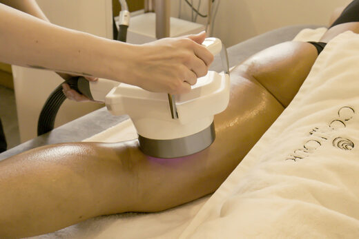 Réduire la cellulite sur les cuisses : quelles solutions efficaces ?